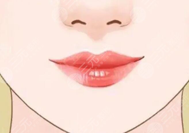 紋唇手術(shù)