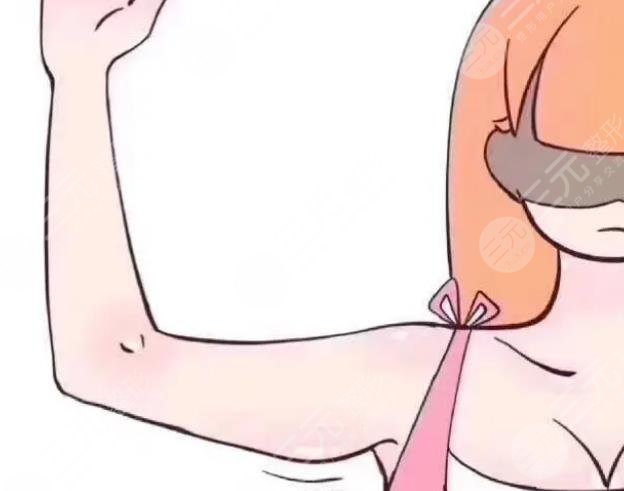 手臂吸脂