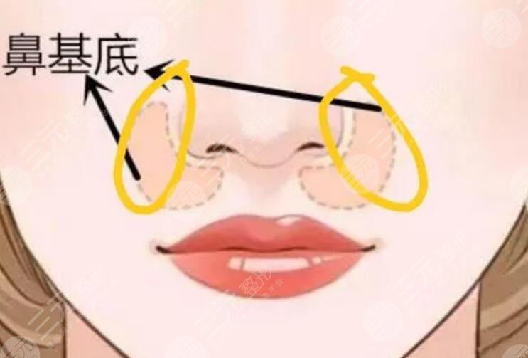 鼻基底