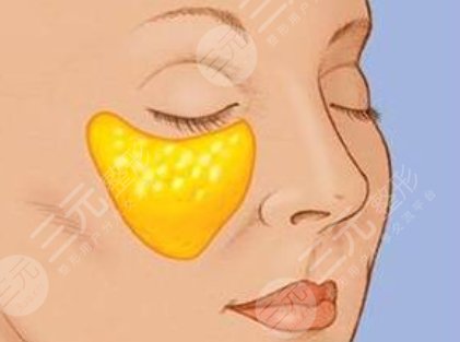 peek眉心三角區(qū)