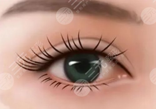 李圣利醫(yī)生雙眼皮修復(fù)怎么樣