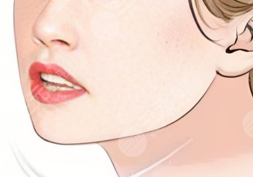 劉先超磨骨怎么樣