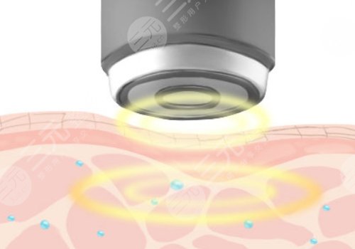 京蒂凡妮醫(yī)療王志堅(jiān)做的提升緊致怎么樣