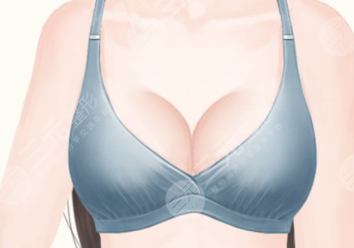 上海九醫(yī)院徐華和王濤乳房再造哪個好