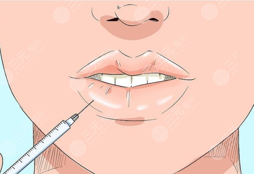 厚唇改薄項(xiàng)目