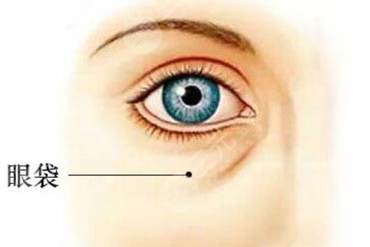 眼袋