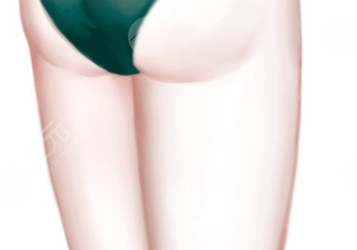 南方醫(yī)科大學南方醫(yī)院吸脂多少錢