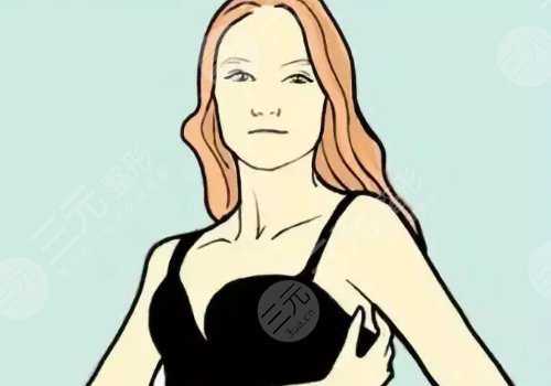 上海東方醫(yī)院隆胸好嗎