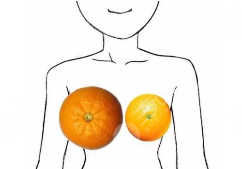 北京協(xié)和曾昂做縮胸手術(shù)怎么樣