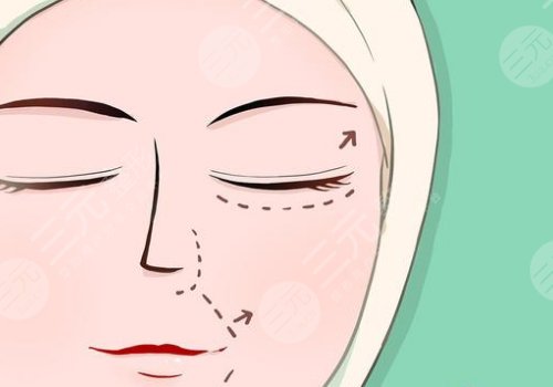 廣州劉杰偉做拉皮手術(shù)怎么樣