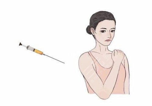 藝星彭才學(xué)抽胳膊怎么樣