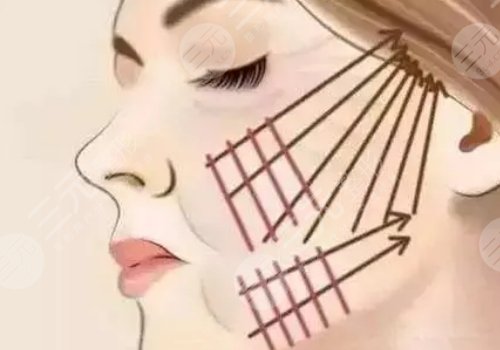 天津伊美爾做拉皮手術(shù)哪個(gè)醫(yī)生好？袁志瑋醫(yī)生值得信賴！