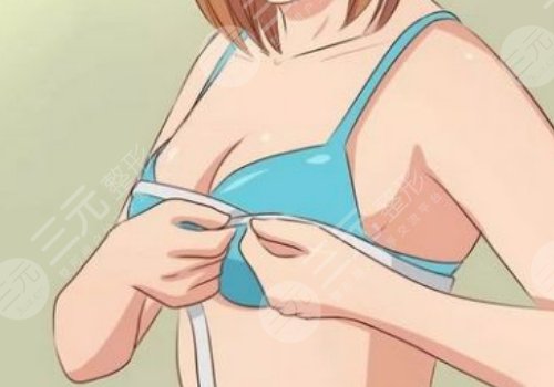 甘泉涌醫(yī)生取隆胸假體怎么樣？那里坐診？疑問解答及2025價格參考