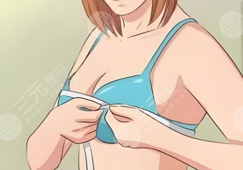 杭州藝星隆胸傲諾拉星熠多少錢