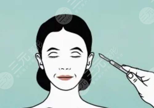 北京加減美黃寅守面部提升怎樣