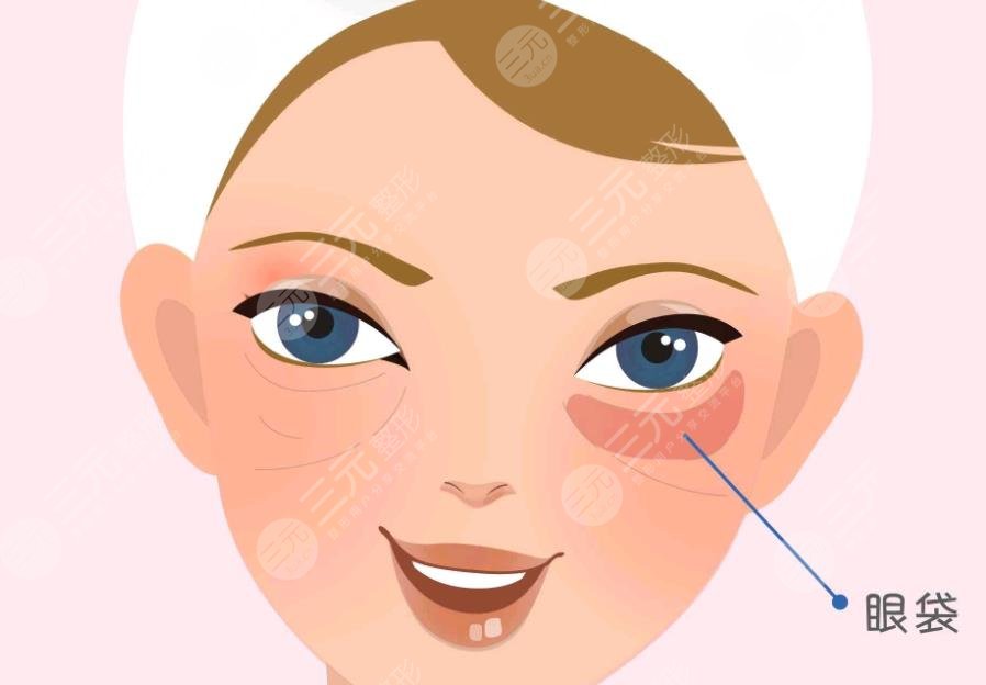 眼袋