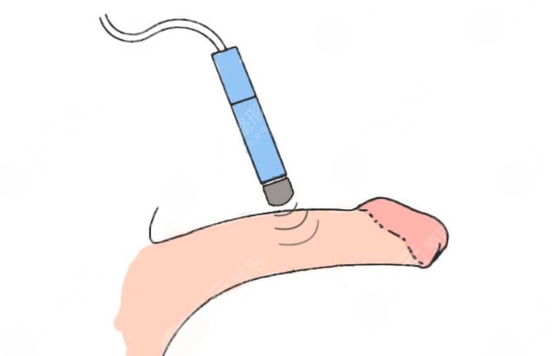 南京男性增大增粗手術(shù)需要多少錢(qián)?