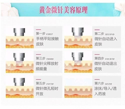 痤瘡疤痕修復(fù)、私密年輕化