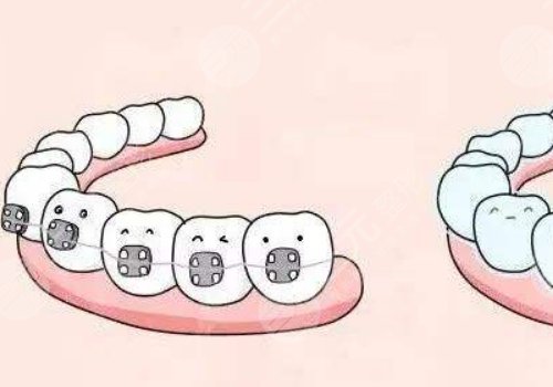 上海醫(yī)大醫(yī)院牙齒矯正