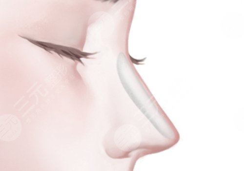 貴州省三醫(yī)院隆鼻