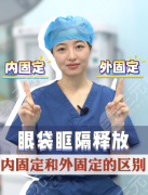 眶隔釋放內(nèi)固定和外固定哪個(gè)好？沒(méi)有最好，只有最適配