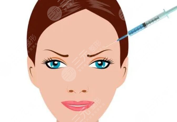 玻尿酸注射