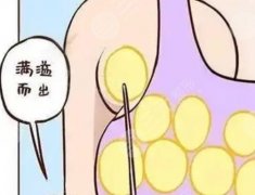 做副乳吸脂后應(yīng)注意事項(xiàng),錢(qián)花在刀口還是刀把？看完不懵