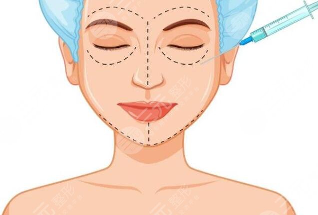 注玻尿酸