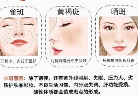 祛斑