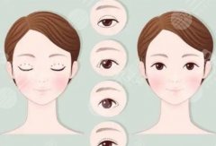 九江學(xué)院附屬醫(yī)院做雙眼皮要多少錢(qián)？全新收費(fèi)細(xì)節(jié)等你來(lái)看！