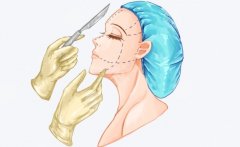 上海時(shí)光整形頜面好不好？下頜角、下巴、顴骨磨骨案例與口碑大曝光