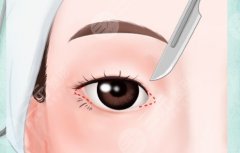 成都眼修復(fù)做的好的醫(yī)生，口碑較好的眼修復(fù)醫(yī)生名單及風(fēng)格解析