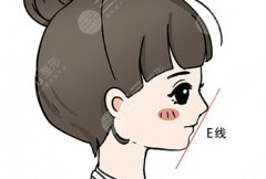 頦成型和正頜手術(shù)什么區(qū)別？頦成型 vs 正頜手術(shù)的核心區(qū)別與選擇思路解析