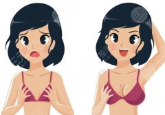 華西醫(yī)院隆胸掛什么科？流程、科室選擇和術(shù)前準(zhǔn)備步驟詳解