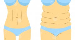 胃包吸脂有什么副作用？可能出現(xiàn)的副作用與風(fēng)險(xiǎn)，一篇講清