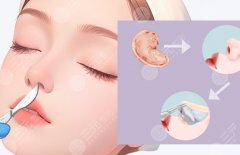 浙二醫(yī)院隆鼻哪個(gè)醫(yī)生好？幾位擅長(zhǎng)鼻整形的醫(yī)生名單及特點(diǎn)盤(pán)點(diǎn)