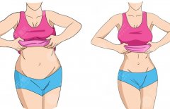 做雙c腰的副作用，可能的并發(fā)癥和術(shù)后不適一文講清，幫你理性決策